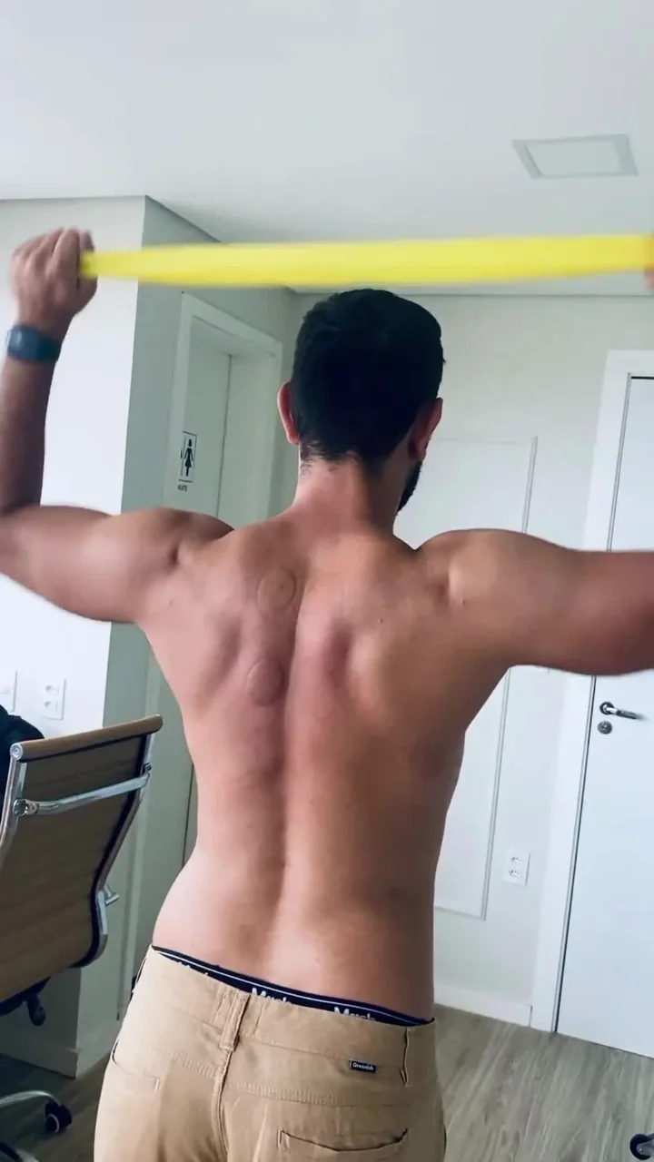 Vídeo clínico: exercício de mobilidade escapular após terapia manual